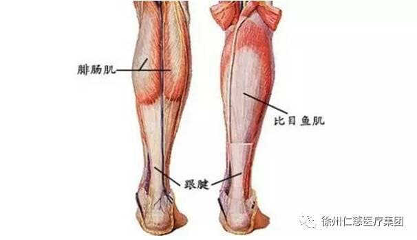 徐州仁慈医院手外科微创治疗足跟痛 术后让你健步如飞