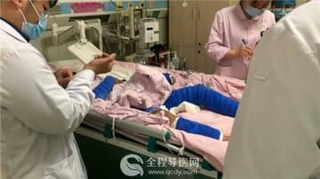 12岁男童大面积烧伤 徐州市儿童医院烧伤科精心施治助其恢复