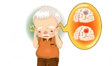 徐州疾控科普:卒中识别早,救治效果好!