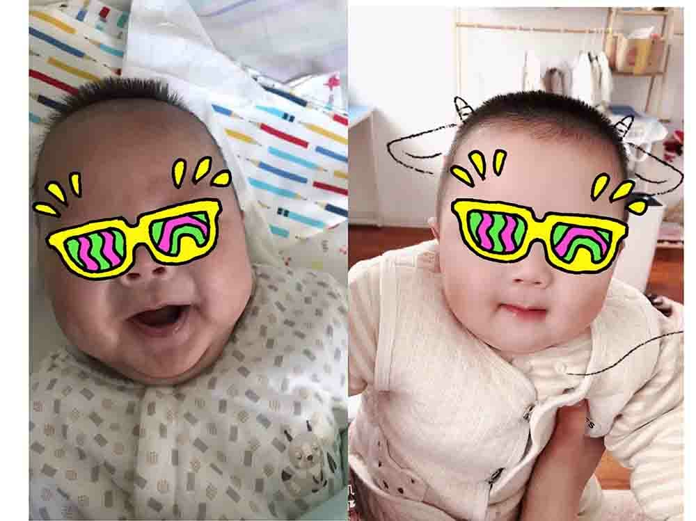 市妇幼保健院新生儿医学中心医患携手再创奇迹 1340克宝宝成功闯关