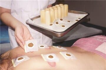 徐州中医专家提醒：穴位敷贴并非人人适合 长期坚持才有疗效