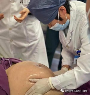 徐州市中心医院产科外倒转术 助臀位宝宝“华丽转身” 成功顺产