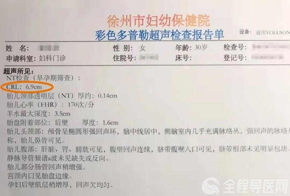 在分子生物学中nt和bp单位有什么区别 百度知道