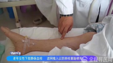 术后又进医院！徐州市肿瘤医院介入科：卧床休养小心静脉血栓