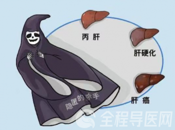 警惕“沉默的杀手”——丙肝