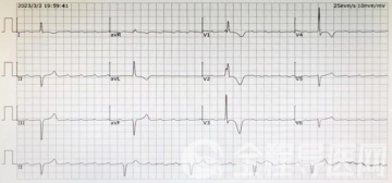 徐州市儿童医院心血管内科专家带您了解——暴发发性心肌炎