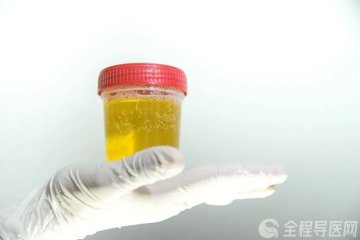 徐州市肿瘤医院科普：小便里有很多泡沫，可能暗示存在这些问题……