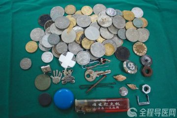 硬币、纽扣、别针…什么都敢吃!徐州市儿童医院专家提醒:看护好孩子!