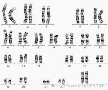 徐州一院检验科：关于染色体核型分析检查，您必须知道的！