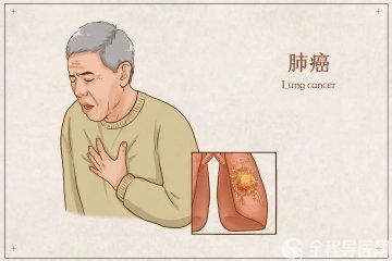 徐州市肿瘤医院健康科普：肺癌早期症状不明显，9种常见表现要知道！