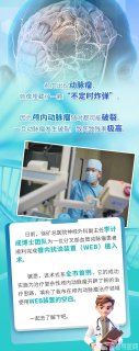 全市首例!徐矿总医院神经外科团队成功施行瘤内扰流装置(WEB)植入术