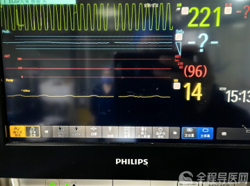 徐医附院急诊体外心肺复苏（ECPR）为2名心脏骤停患者按下生命重启键