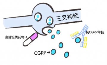 徐矿总医院神经内科张俊:偏头痛折磨难忍?别忍了!应对方法看这里!