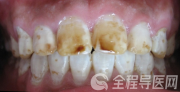徐州一院口腔科自8月份起开设洁牙美牙专病门诊