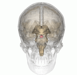 徐州一院神经外科成功为一名巨大侵袭性垂体瘤患者揪出潜藏的“元凶”