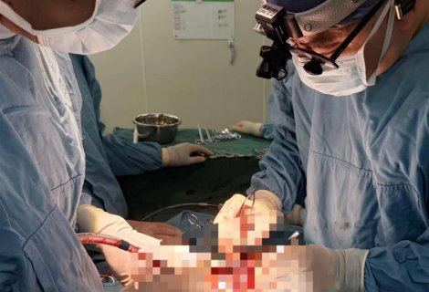 徐州市中心医院心脏外科应用“衬裙Commando”术成功治疗复杂双瓣膜病变患者