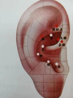 徐州市中医院中医适宜护理技术 解锁便秘患者畅通之道